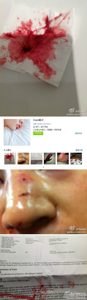 Attack on Chinese international students in Sydney - screen captures from Xuan's Weibo